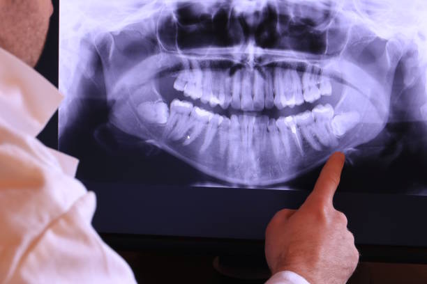 Best Emergency Tooth Extraction in Nashville, GA